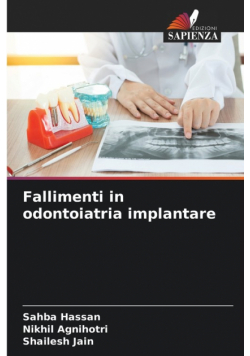 Fallimenti in odontoiatria implantare