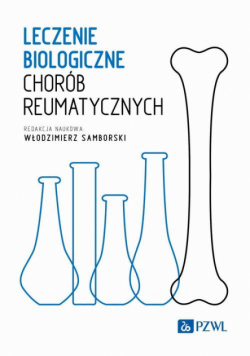 Leczenie biologiczne chorób reumatycznych