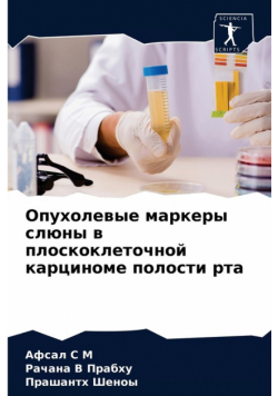 Опухолевые маркеры слюны в плоскоклеточной карциноме полости рта