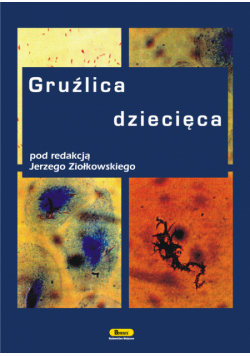 Gruźlica dziecięca
