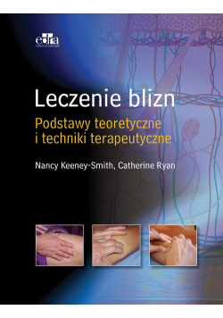 Leczenie blizn Podstawy teoretyczne i techniki terapeutyczne