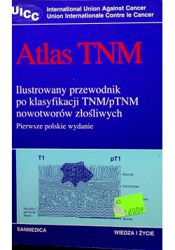 Atlas TNM