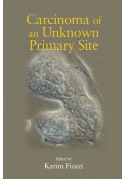 Carcinoma of an Unknown Primary Site