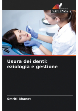 Usura dei denti