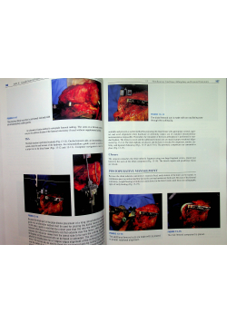 Master Techniques in Orthopaedic Surgery Knee Arthroplasty