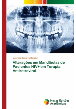 Alterações em Mandíbulas de Pacientes HIV+ em Terapia Antiretroviral