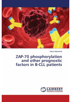 Zap-70 Phosphorylation and Other Prognostic Factors in B-CLL Patients