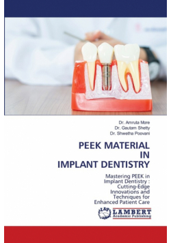 Peek Material In Implant Dentistry