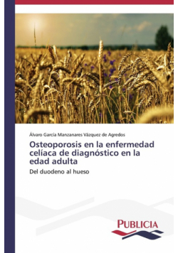 Osteoporosis en la enfermedad celíaca de diagnóstico en la edad adulta
