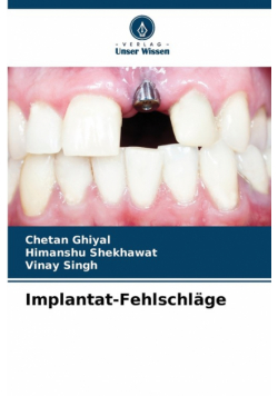 Implantat-Fehlschläge