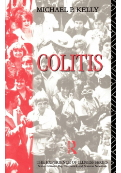 Colitis