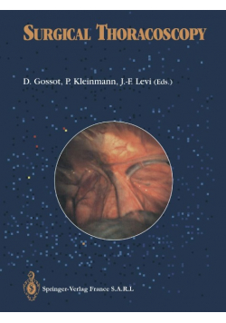 Surgical thoracoscopy