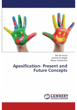 Apexification- Present and Future Concepts