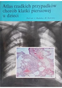 Atlas rzadkich przypadków chorób klatki piersiowej u dzieci