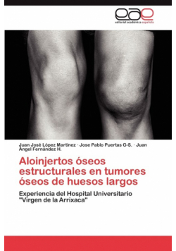 Aloinjertos óseos estructurales en tumores óseos de huesos largos