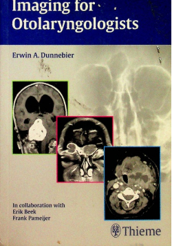 Imaging for Otolaryngologists
