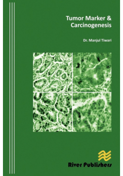 Tumor Marker & Carcinogenesis