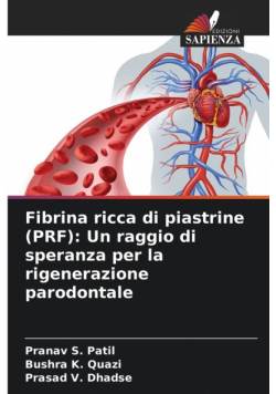 Fibrina ricca di piastrine (PRF)