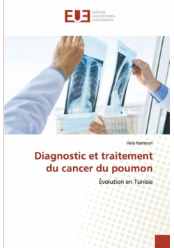 Diagnostic et traitement du cancer du poumon