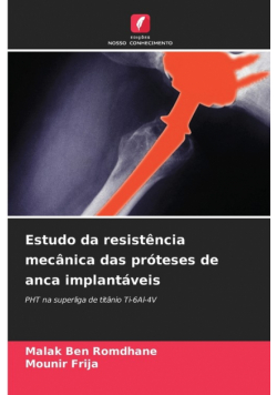 Estudo da resistência mecânica das próteses de anca implantáveis