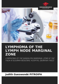 Lymphoma Of The Lymph Node Marginal Zone