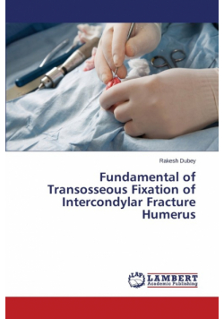 Fundamental of Transosseous Fixation of Intercondylar Fracture Humerus