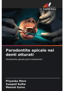 Parodontite apicale nei denti otturati
