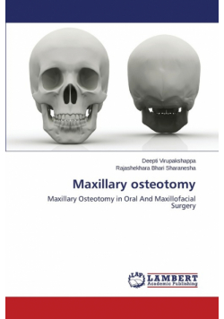 Maxillary Osteotomy
