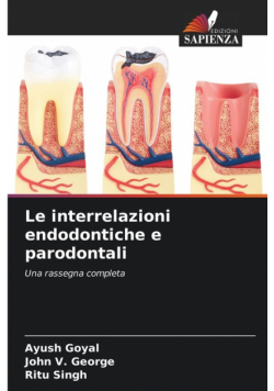 Le interrelazioni endodontiche e parodontali