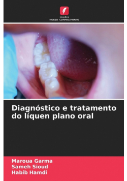 Diagnóstico e tratamento do líquen plano oral