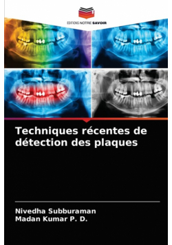 Techniques récentes de détection des plaques