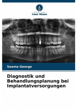 Diagnostik und Behandlungsplanung bei Implantatversorgungen