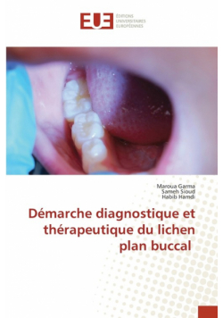 Démarche diagnostique et thérapeutique du lichen plan buccal