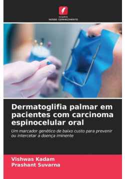 Dermatoglifia palmar em pacientes com carcinoma espinocelular oral