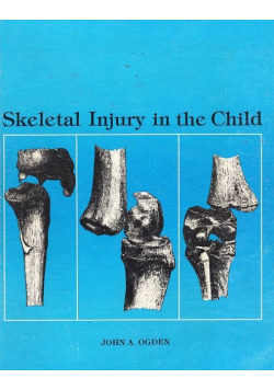 Skeletal Injury in the Child