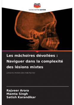 Les mâchoires dévoilées