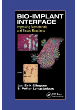 Bio-Implant Interface