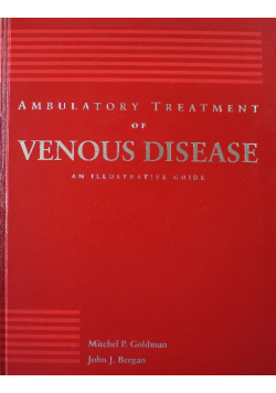 Ambulatory Treatment of Venous Disease