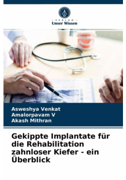 Gekippte Implantate für die Rehabilitation zahnloser Kiefer - ein Überblick