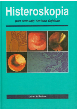Histeroskopia