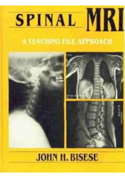 Spinal Mri A Teaching File Approach