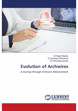 Evolution of Archwires