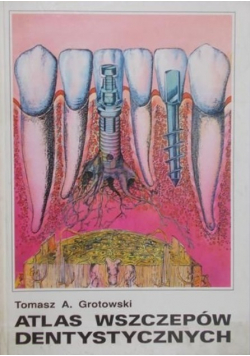 Atlas wszczepów dentystycznych