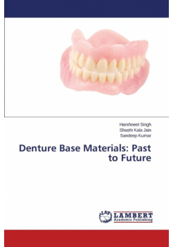 Denture Base Materials