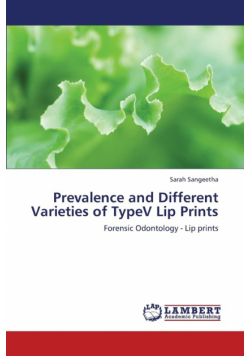 Prevalence and Different Varieties of Typev Lip Prints