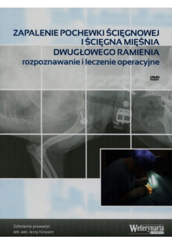 Zapalenie pochewki ścięgnowej iścięgna mięśnia dwugłowego ramienia