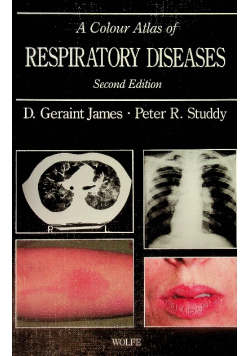 A Colour Atlas of Respiratory Diseases