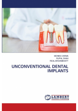 Unconventional Dental Implants