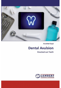 Dental Avulsion