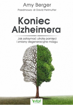 Koniec Alzheimera Jak zatrzymać utratę pamięci i zmiany degeneracyjne mózgu